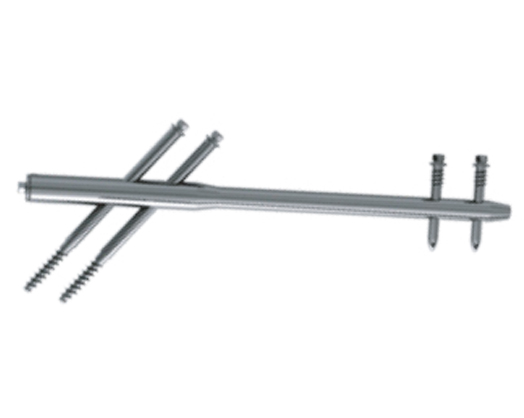 Trauma_Interlocking Nail Systems Reconstruction Femoral Interlocking Nail (Standard Gamma Nail)