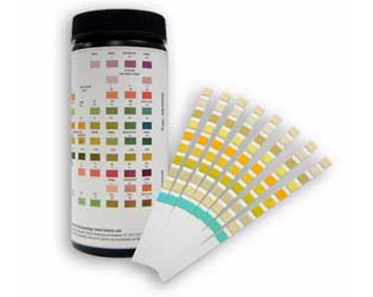 Urine Analysis Strips