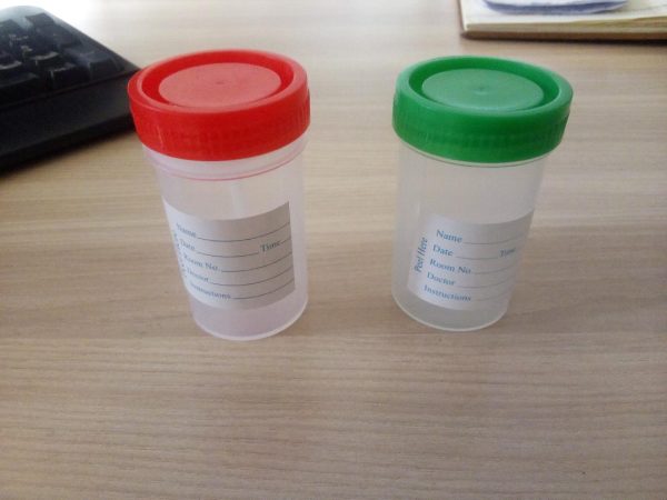 urine and stool containers Kenya