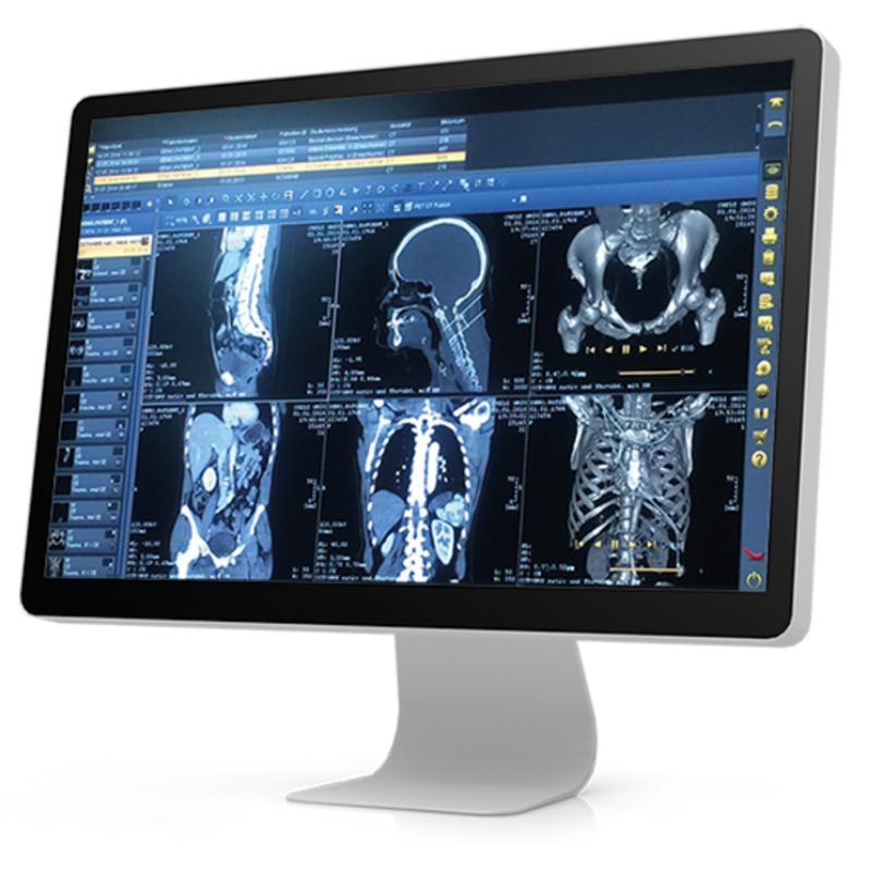 Radiology Ultrasound Imaging Equipment GM Medical Kenya